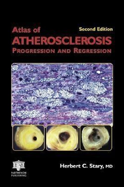 Cover Art for 9780203490709, Atlas of Atherosclerosis: Progression and Regression by Herbert C Stary