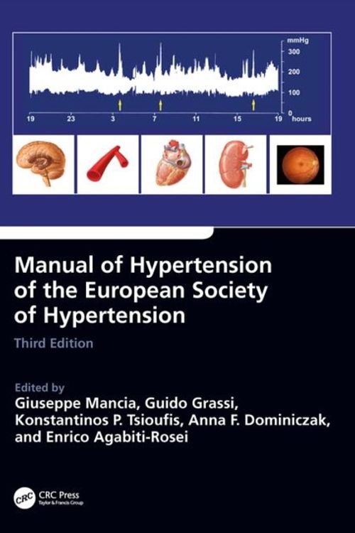 Cover Art for 9780815378747, Manual of Hypertension of the European Society of Hypertension, Third Edition by Anna Dominiczak