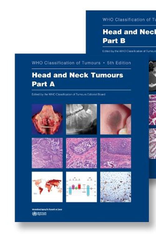 Cover Art for 9789283245148, Head and Neck Tumours: Who Classification of Tumours by Unknown