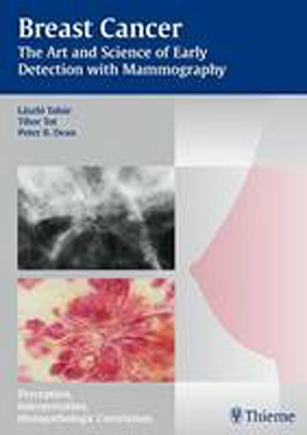 Cover Art for 9783131353719, Mammography - The Art and Science of Early Detection by Laszlo Tabar